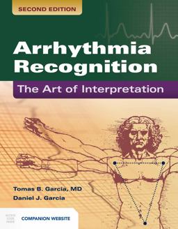 Arrhythmia Recognition: The Art of Interpretations  9781449642334 Front Cover