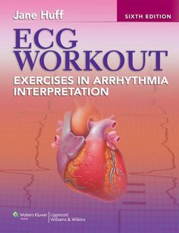 ECG Workout Exercises in Arrhythmia Interpretation 6th 9781451115536 Front Cover