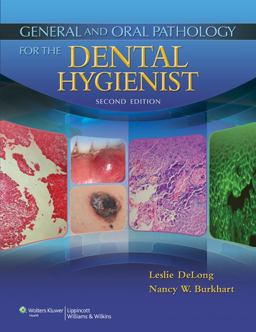 General and Oral Pathology for the Dental Hygienist 2nd 9781451131536 Front Cover