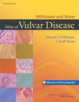Wilkinson and Stone Atlas of Vulvar Disease 3rd 9781451132182 Front Cover