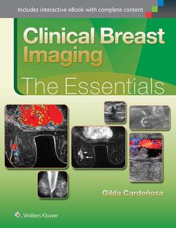 Clinical Breast Imaging: the Essentials  9781451151770 Front Cover