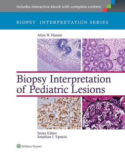 Biopsy Interpretation of Pediatric Lesions  9781451175332 Front Cover