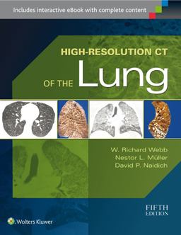 High-Resolution CT of the Lung 5th 9781451176018 Front Cover