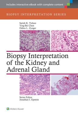 Biopsy Interpretation of the Kidney and Adrenal Gland  9781451176476 Front Cover