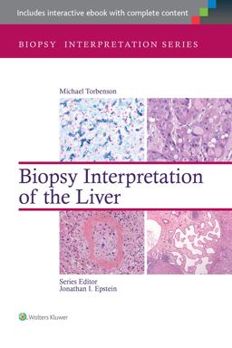 Biopsy Interpretation of the Liver 3rd 9781451182576 Front Cover
