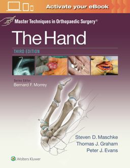 Master Techniques in Orthopaedic Surgery: the Hand
