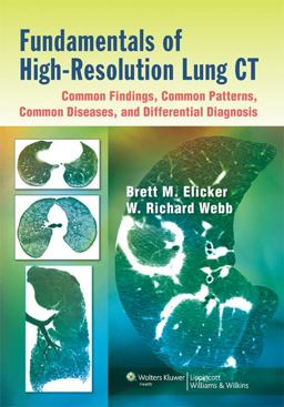 Fundamentals of High-Resolution Lung CT Common Findings, Common Patterns, Common Diseases, and Differential Diagnosis  9781451184082 Front Cover