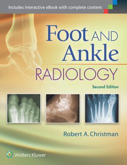 Foot and Ankle Radiology 2nd 9781451192834 Front Cover