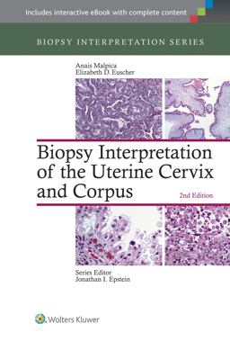 Biopsy Interpretation of the Uterine Cervix and Corpus 2nd 9781451192964 Front Cover