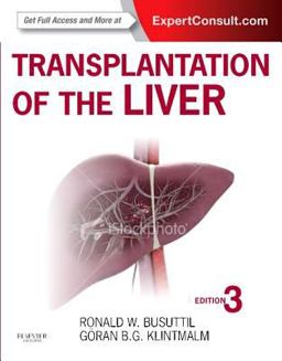 Transplantation of the Liver 3rd 9781455702688 Front Cover