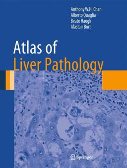 Atlas of Liver Pathology  9781461491132 Front Cover