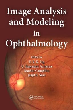 Image Analysis and Modeling in Opthalmology