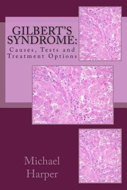 Gilbert's Syndrome: Causes, Tests and Treatment Options Gilbert's Syndrome: Causes, Tests and Treatment Options