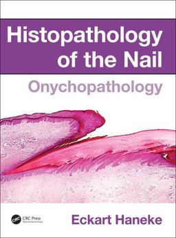 Histopathology of the Nail Onychopathology  9781482212327 Front Cover