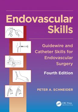 Endovascular Skills: Guidewire and Catheter Skills for Endovascular Surgery  9781482217377 Front Cover