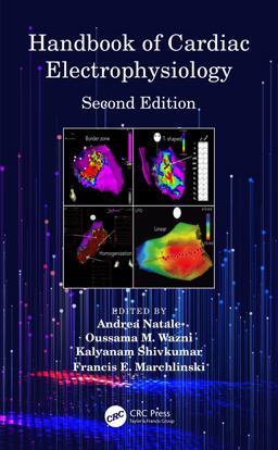 Handbook of Cardiac Electrophysiology 2nd 9781482224399 Front Cover
