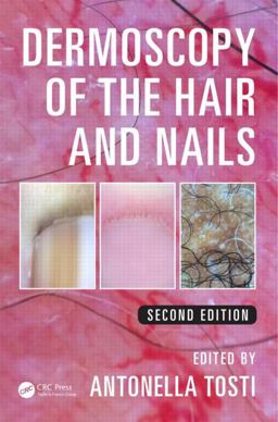 Dermoscopy of the Hair and Nails:  9781482234053 Front Cover