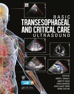 Basic Transesophageal and Critical Care Ultrasound  9781482237122 Front Cover