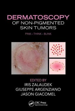 Dermatoscopy of Non-Pigmented Skin Tumors Pink - Think - Blink  9781482237528 Front Cover
