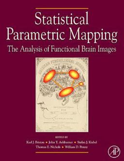 Statistical Parametric Mapping: the Analysis of Functional Brain Images