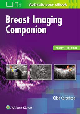 Breast Imaging Companion 4th 9781496314963 Front Cover