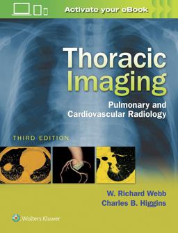Thoracic Imaging:  9781496321046 Front Cover