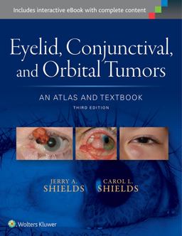 Atlas Eyelid Conjun Orbital Tumors 3rd 9781496321480 Front Cover