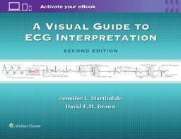 Visual Guide to ECG Interpretation 2nd 9781496321534 Front Cover