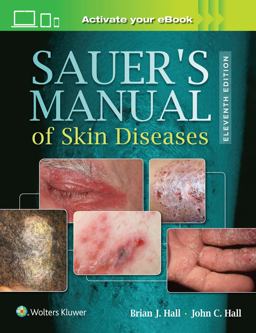 Sauer's Manual of Skin Diseases 11th 9781496329936 Front Cover