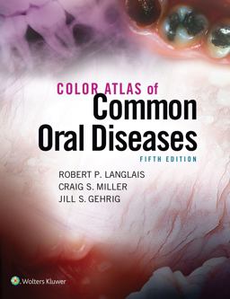 Color Atlas of Common Oral Diseases 5th 9781496332080 Front Cover