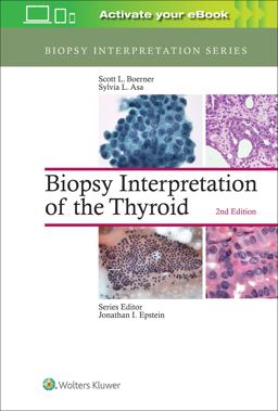 Biopsy Interpretation of the Thyroid 2nd 9781496355850 Front Cover