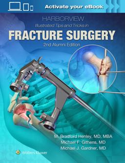 Harborview Illustrated Tips and Tricks in Fracture Surgery 2nd 9781496355980 Front Cover