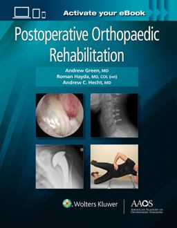 Postoperative Orthopaedic Rehabilitation: Print + Ebook Postoperative Orthopaedic Rehabilitation: Print + Ebook