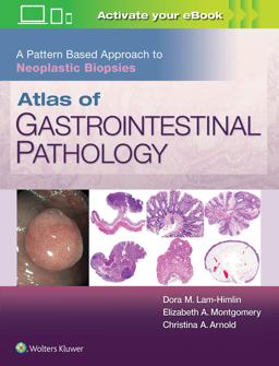 Atlas of Gastrointestinal Pathology A Pattern Based Approach to Neoplastic Biopsies  9781496367549 Front Cover