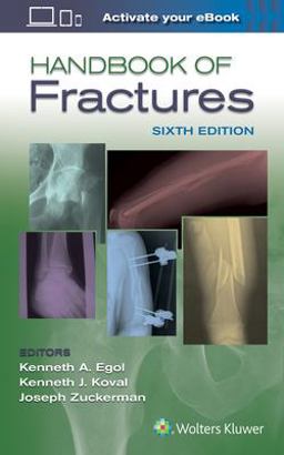Handbook of Fractures 6th 9781496384850 Front Cover