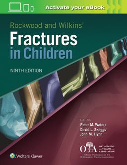 Rockwood and Wilkins Fractures in Children:  9781496386540 Front Cover