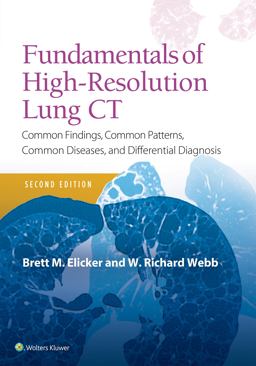Fundamentals of High-Resolution Lung CT Common Findings, Common Patterns, Common Diseases and Differential Diagnosis 2nd 9781496389923 Front Cover