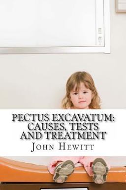 Pectus Excavatum Pectus Excavatum