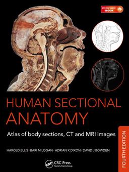 Human Sectional Anatomy Atlas of Body Sections, CT and MRI Images, Fourth Edition 4th 9781498703604 Front Cover