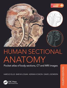 Human Sectional Anatomy Pocket Atlas of Body Sections, CT and MRI Images, Fourth Edition 4th 9781498708548 Front Cover