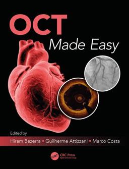 OCT Made Easy  9781498714563 Front Cover