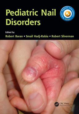Pediatric Nail Disorders  9781498720458 Front Cover