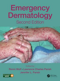 Emergency Dermatology 2nd 9781498729314 Front Cover