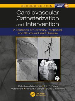 Cardiovascular Catheterization and Intervention A Textbook of Coronary, Peripheral, and Structural Heart Disease, Second Edition 2nd 9781498750196 Front Cover