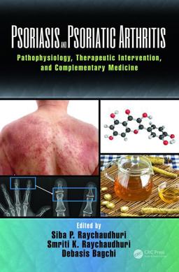 Psoriasis and Psoriatic Arthritis Pathophysiology, Therapeutic Intervention, and Complementary Medicine  9781498756068 Front Cover
