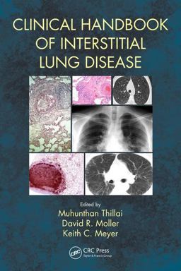 Clinical Handbook of Interstitial Lung Disease  9781498768252 Front Cover