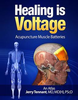 Healing Is Voltage: Acupuncture Muscle Batteries 2015 9781508500728 Front Cover