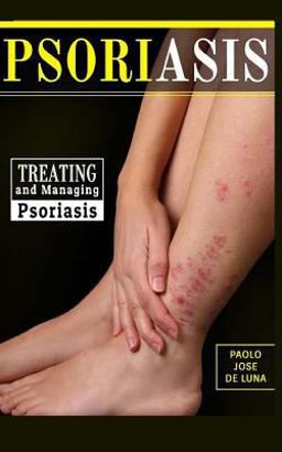 Psoriasis Psoriasis