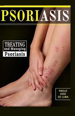 Psoriasis Psoriasis