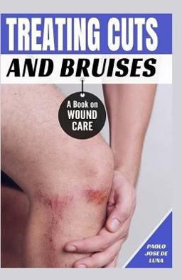Treating Cuts and Bruises Treating Cuts and Bruises